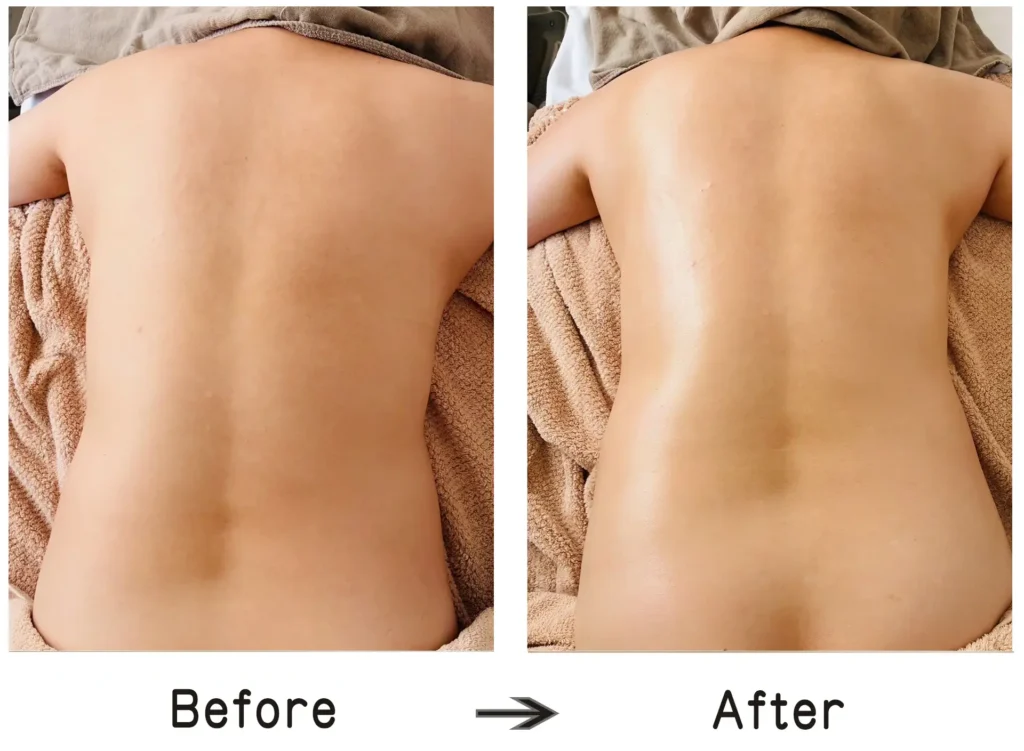 美整筋メソッド施術例