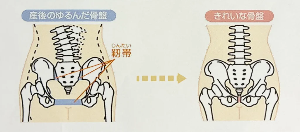 骨盤調整イメージ